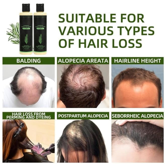 š± Organic Rosemary Hair Growth Shampoo