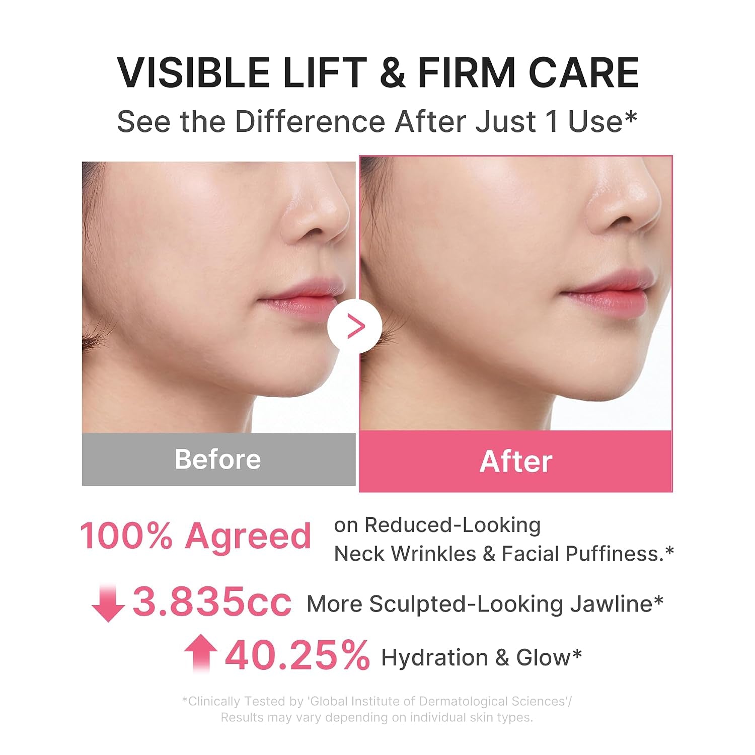 PDRN Collagen Gua Sha Neck Wrinkle Cream | Built-In Gua Sha Massager with Volufiline 5% + PDRN