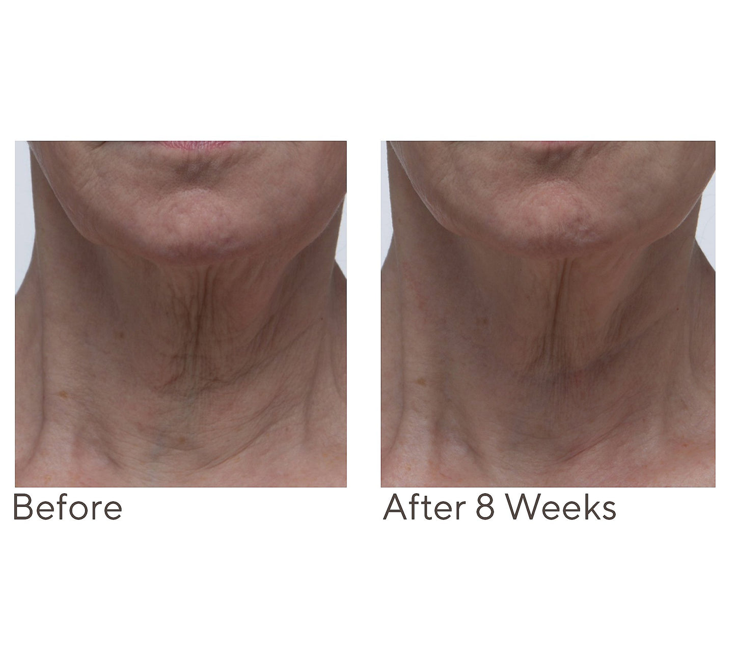Crepe Erase Neck Repair Treatment Home & AWay 2pc Set