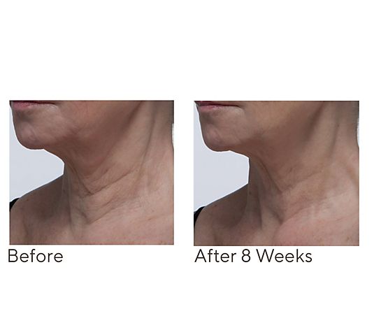 Crepe Erase Neck Repair Treatment Home & AWay 2pc Set