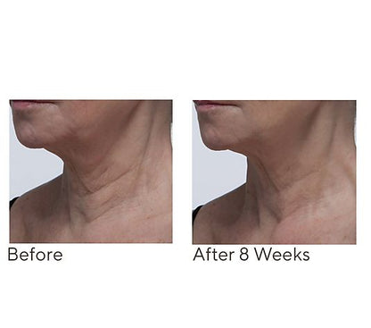 Crepe Erase Neck Repair Treatment Home & AWay 2pc Set