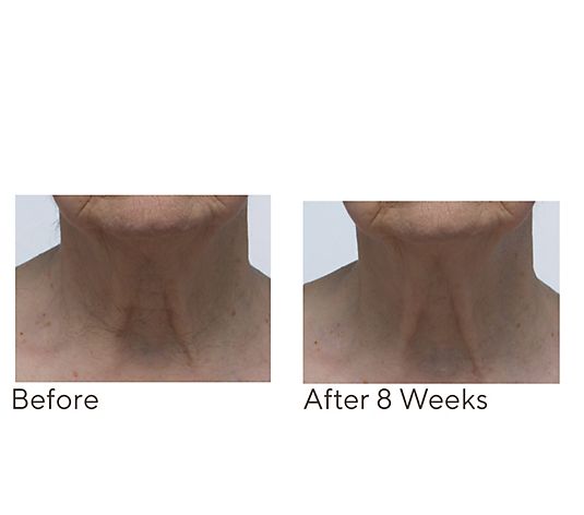 Crepe Erase Neck Repair Treatment Home & AWay 2pc Set