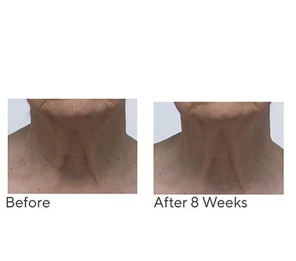Crepe Erase Neck Repair Treatment Home & AWay 2pc Set
