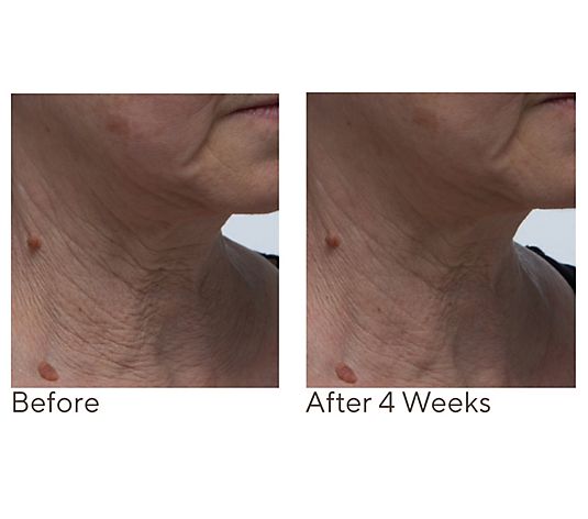 Crepe Erase Neck Repair Treatment Home & AWay 2pc Set