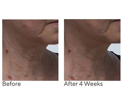 Crepe Erase Neck Repair Treatment Home & AWay 2pc Set