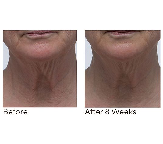 Crepe Erase Neck Repair Treatment Home & AWay 2pc Set
