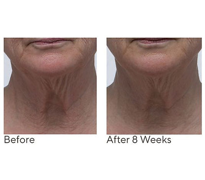 Crepe Erase Neck Repair Treatment Home & AWay 2pc Set