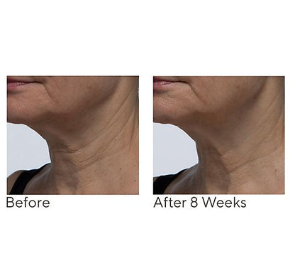 Crepe Erase Neck Repair Treatment Home & AWay 2pc Set