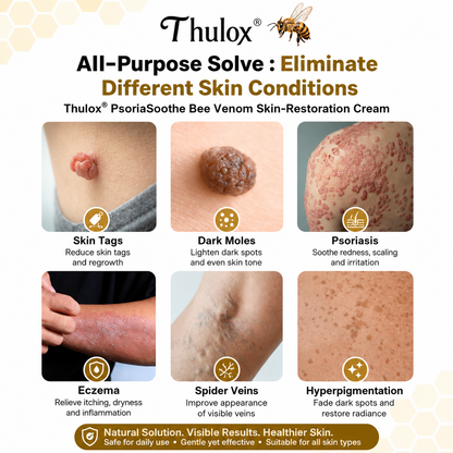 Thulox® PsoriaSoothe Bee Venom Skin-Restoration Cream ✨