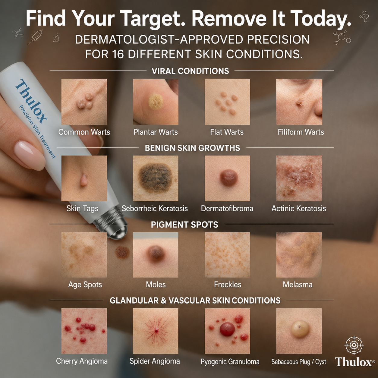 𝐎𝐟𝐟𝐢𝐜𝐢𝐚𝐥 𝐒𝐭𝐨𝐫𝐞 𝐁𝐫𝐚𝐧𝐝 | Tlulox®  👩‍⚕️ 𝐓𝐥𝐮𝐥𝐨𝐱® 7-Day Skin Tag & Dark Spot Remover (Pain-free roll-on applicator · No scars · Gentle skin care solution) 🌱
