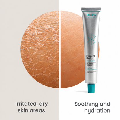 Instant Relief Treatment