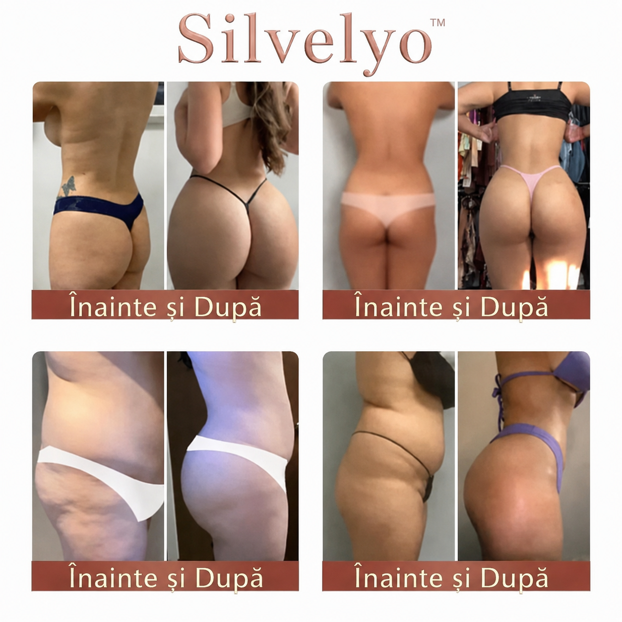 Silvelyo™ CurveSculpt Micro-Patch – Secretul tău pentru un efect de lifting al feselor, direct acasă 🍑