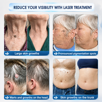🔥 Natrvor® 7-Day Skin Tag & Dark Spot Care Roller Pain-Free • No Scar Marks • Precision Rollerball Applicator 🌈