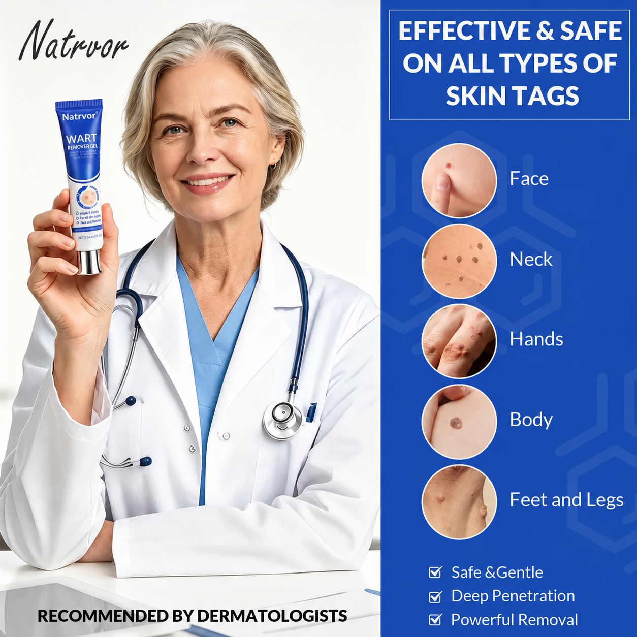 Natrvor® WART REMOVER GEL