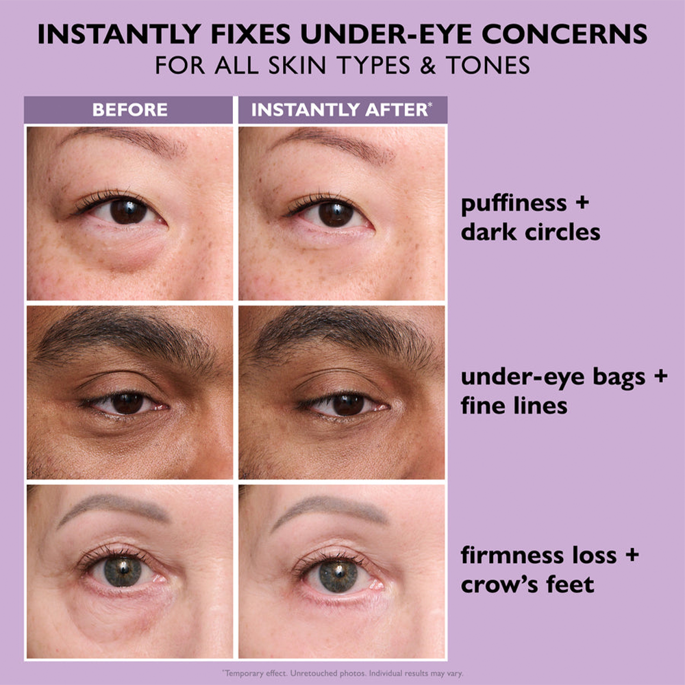 Eye Bag Instant Eraser, Tightens, Firms, & Blurs Wrinkles result image