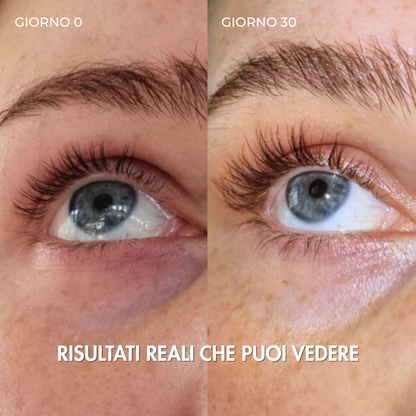 SIERO PER CIGLIA