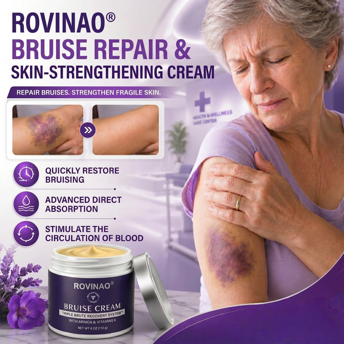 💥 150K+ Sold | ROVINAO® Bruise Repair Cream – Fade Bruises & Strengthen Fragile Skin