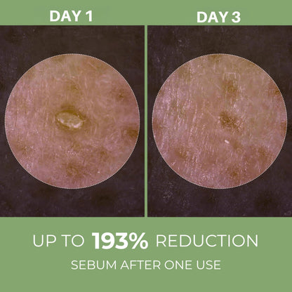 Olivine Beauty Peel Shot exfoliating ampoule helping reduce sebum and refine pores
