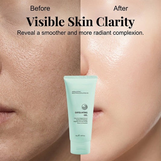 🥳2026 HOT SALE🥳💞50K+ SOLD!💥👵🌸 50% OFF!Herbal Extract Brightening Exfoliating Gel